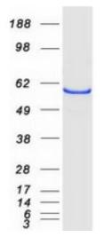 SDS-PAGE (CYP46A1-221HFL).jpg